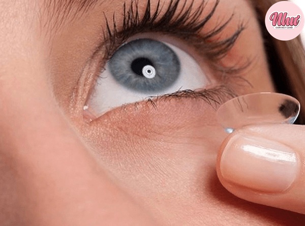Có nhiều nguyên nhân dẫn đến đeo lens bị cay mắt